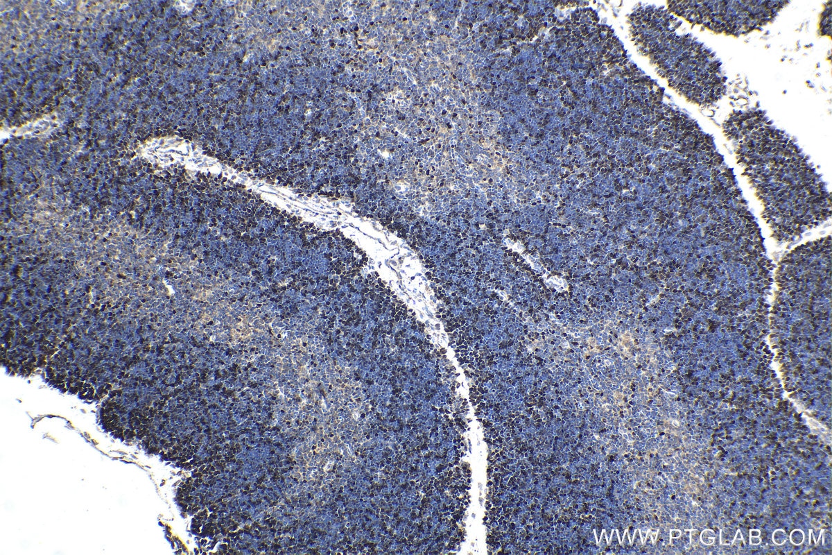 Immunohistochemistry (IHC) staining of mouse thymus tissue using HELLS Polyclonal antibody (11955-1-AP)