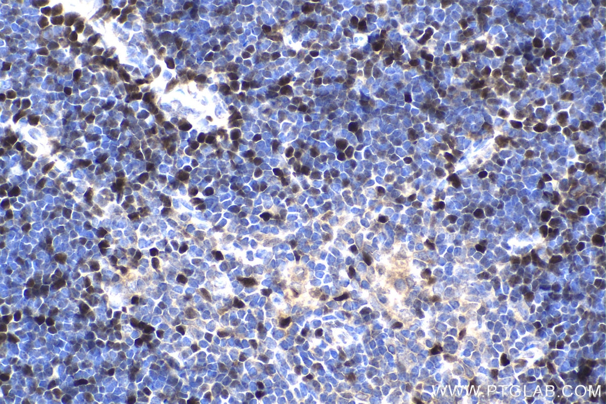 Immunohistochemistry (IHC) staining of mouse thymus tissue using HELLS Polyclonal antibody (11955-1-AP)