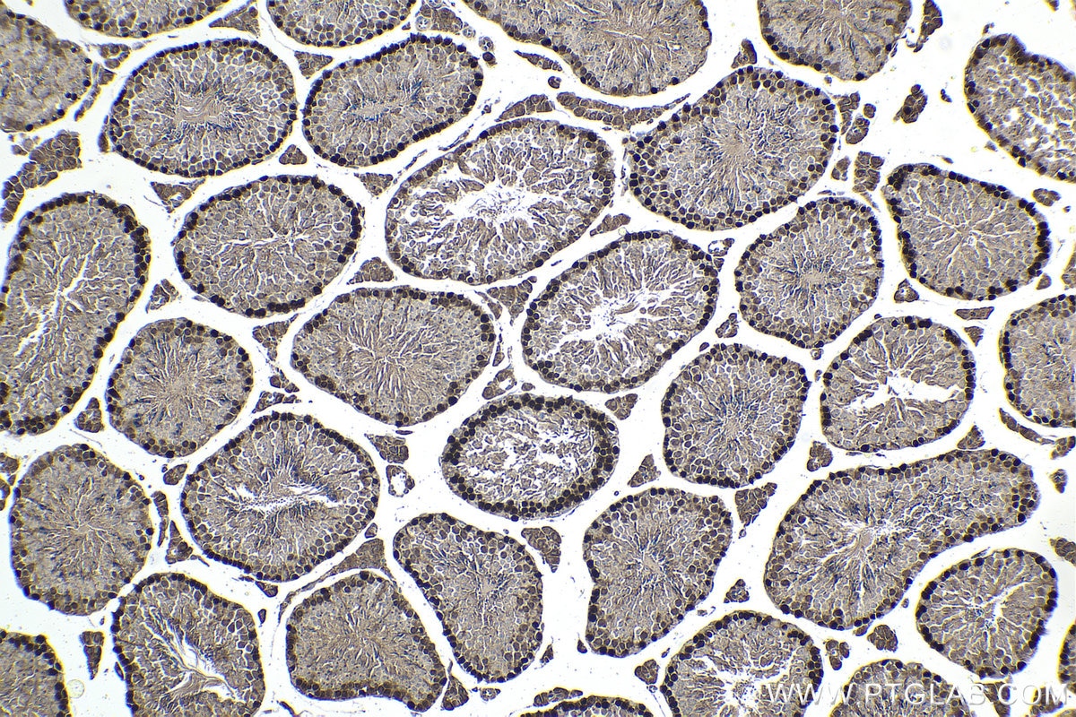 Immunohistochemistry (IHC) staining of mouse testis tissue using HELLS Polyclonal antibody (11955-1-AP)