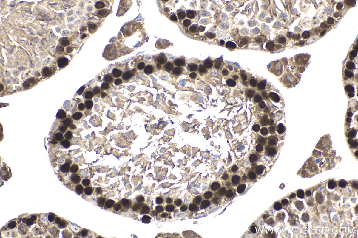 Immunohistochemistry (IHC) staining of mouse testis tissue using HELLS Polyclonal antibody (11955-1-AP)