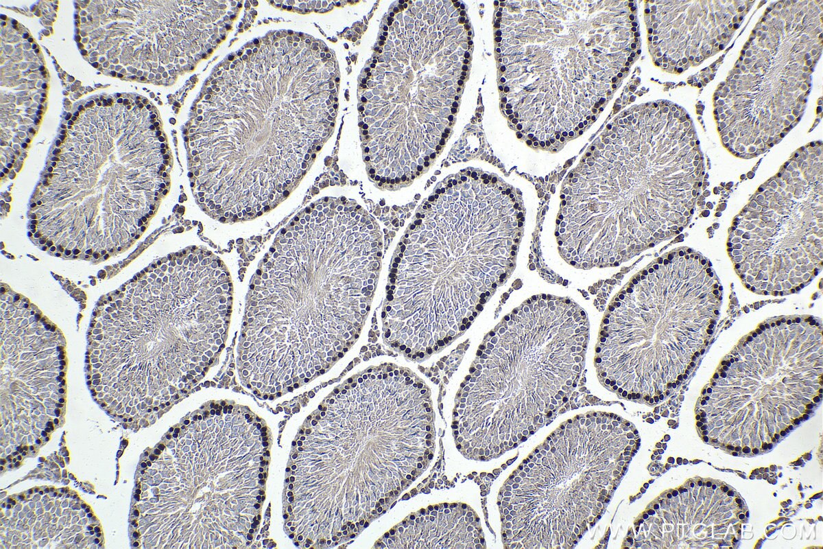 Immunohistochemistry (IHC) staining of rat testis tissue using HELLS Polyclonal antibody (11955-1-AP)