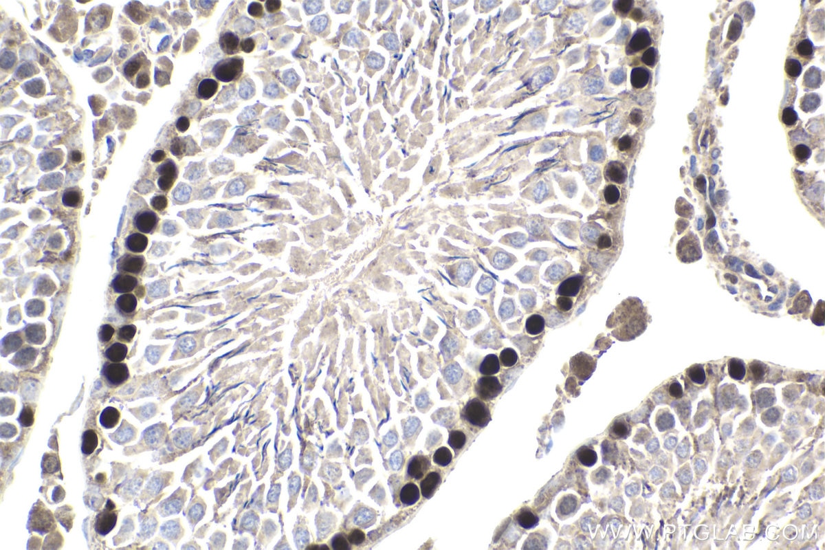 Immunohistochemistry (IHC) staining of rat testis tissue using HELLS Polyclonal antibody (11955-1-AP)