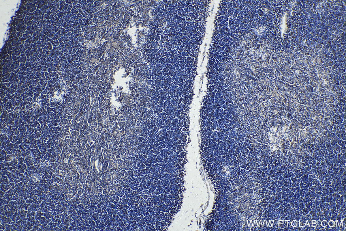 Immunohistochemistry (IHC) staining of rat thymus tissue using HELLS Polyclonal antibody (11955-1-AP)