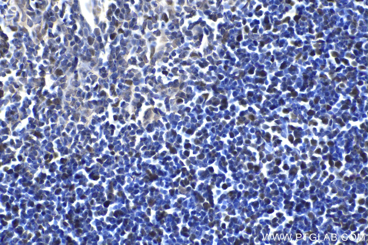 Immunohistochemistry (IHC) staining of rat thymus tissue using HELLS Polyclonal antibody (11955-1-AP)