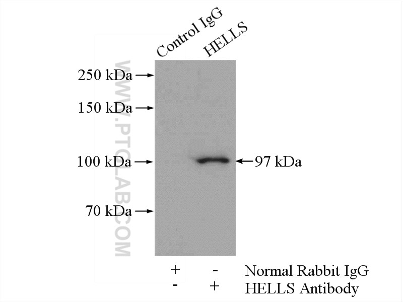 Immunoprecipitation (IP) experiment of mouse testis tissue using HELLS Polyclonal antibody (11955-1-AP)