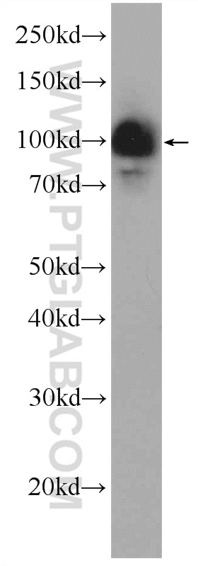 Western Blot (WB) analysis of mouse thymus tissue using HELLS Polyclonal antibody (11955-1-AP)