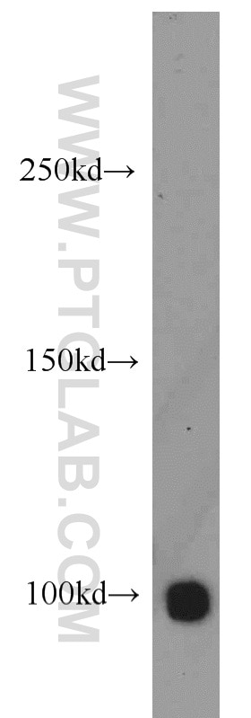 Western Blot (WB) analysis of K-562 cells using HELLS Polyclonal antibody (11955-1-AP)