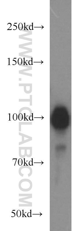 Western Blot (WB) analysis of PC-3 cells using HELLS Polyclonal antibody (11955-1-AP)