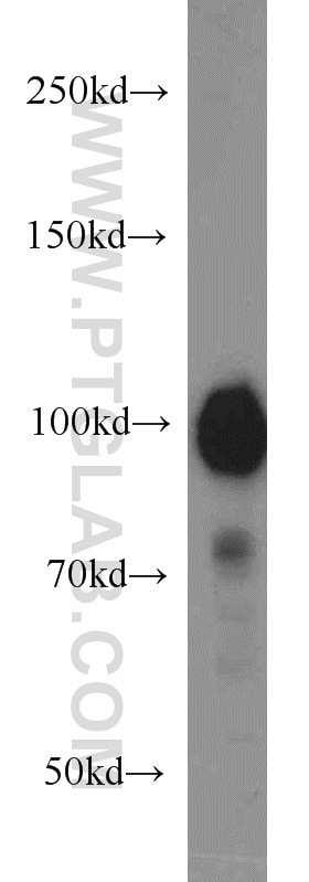Western Blot (WB) analysis of DU 145 cells using HELLS Polyclonal antibody (11955-1-AP)