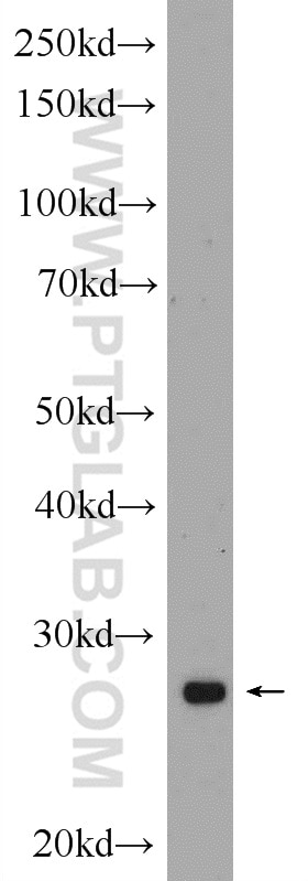 Western Blot (WB) analysis of rat heart tissue using HELT Polyclonal antibody (24730-1-AP)