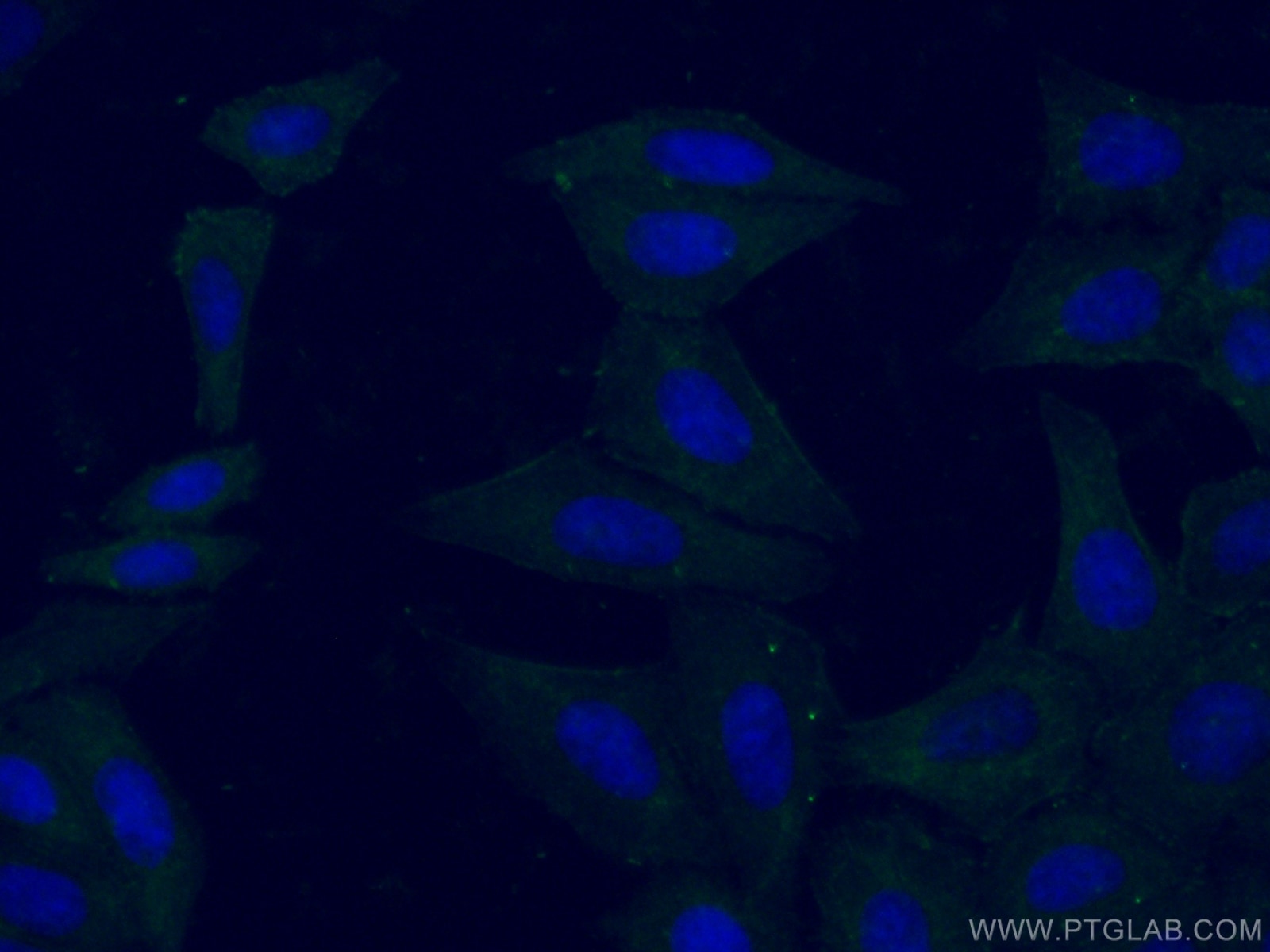 Immunofluorescence (IF) / fluorescent staining of HepG2 cells using HELZ Polyclonal antibody (26635-1-AP)