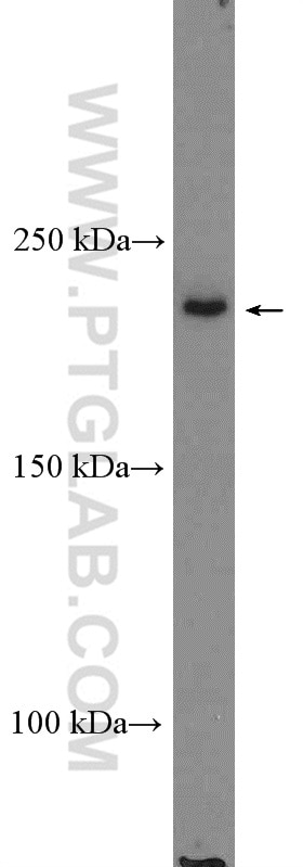 Western Blot (WB) analysis of HeLa cells using HELZ Polyclonal antibody (26635-1-AP)
