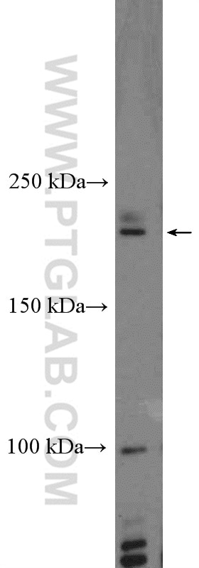 Western Blot (WB) analysis of HeLa cells using HELZ Polyclonal antibody (26635-1-AP)