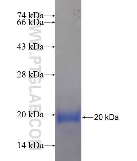 HELZ fusion protein Ag24473 SDS-PAGE