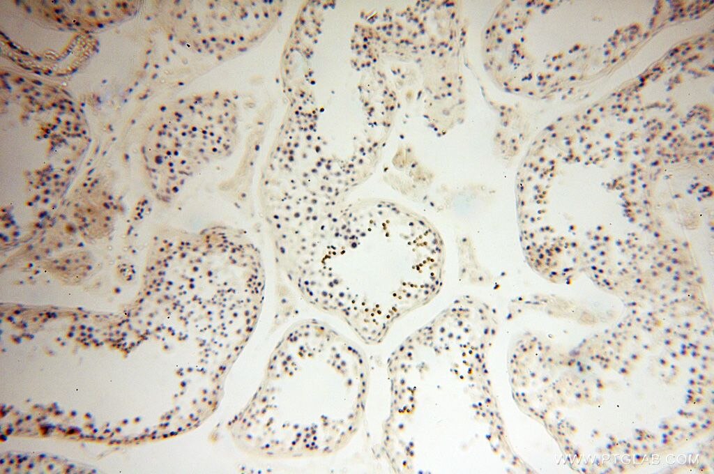 Immunohistochemistry (IHC) staining of human testis tissue using HEMGN Polyclonal antibody (17616-1-AP)