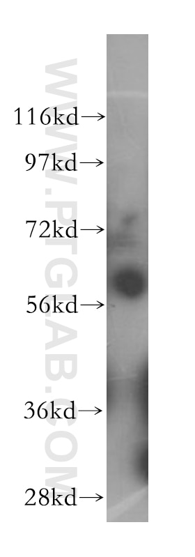 Western Blot (WB) analysis of mouse testis tissue using HEMGN Polyclonal antibody (17616-1-AP)