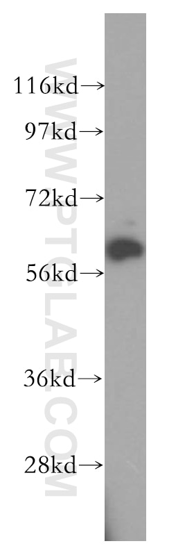 Western Blot (WB) analysis of Jurkat cells using HEMGN Polyclonal antibody (17616-1-AP)