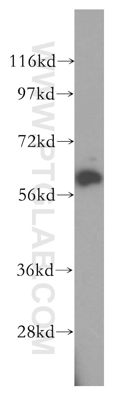 WB analysis of Jurkat using 17616-1-AP