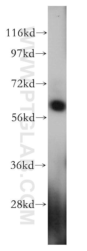 Western Blot (WB) analysis of human testis tissue using HEMGN Polyclonal antibody (17616-1-AP)