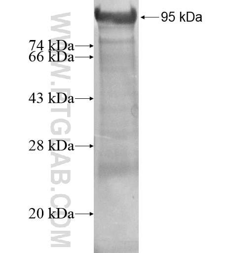 HEMGN fusion protein Ag11793 SDS-PAGE