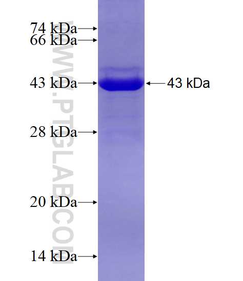 HEMK1 fusion protein Ag7573 SDS-PAGE
