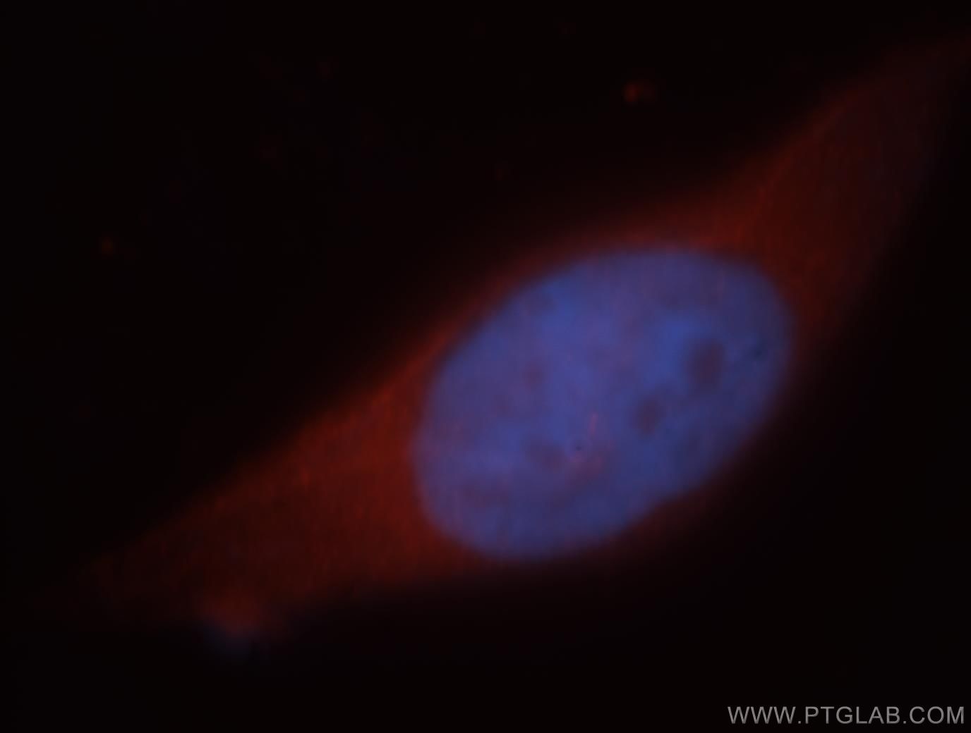 Immunofluorescence (IF) / fluorescent staining of MCF-7 cells using HEPACAM Polyclonal antibody (18177-1-AP)