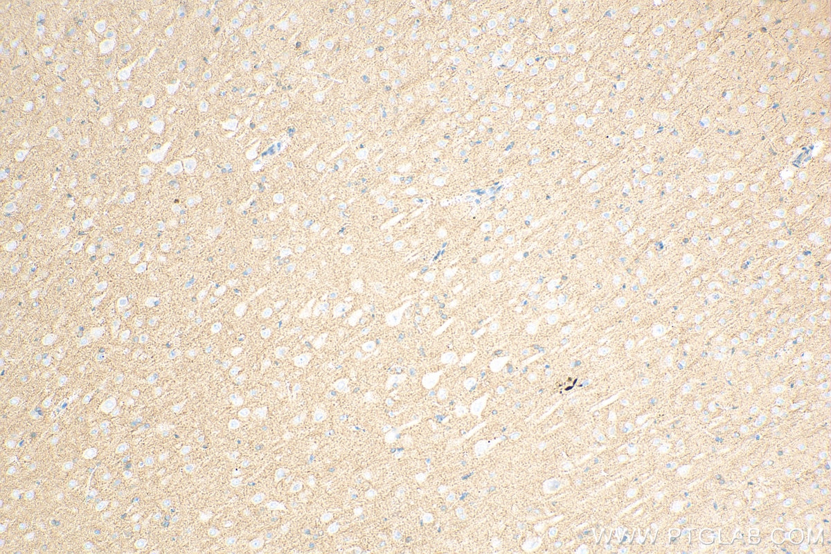 Immunohistochemistry (IHC) staining of rat brain tissue using HEPACAM Polyclonal antibody (18177-1-AP)