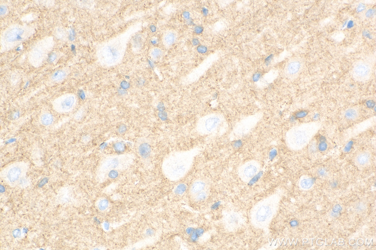 Immunohistochemistry (IHC) staining of rat brain tissue using HEPACAM Polyclonal antibody (18177-1-AP)