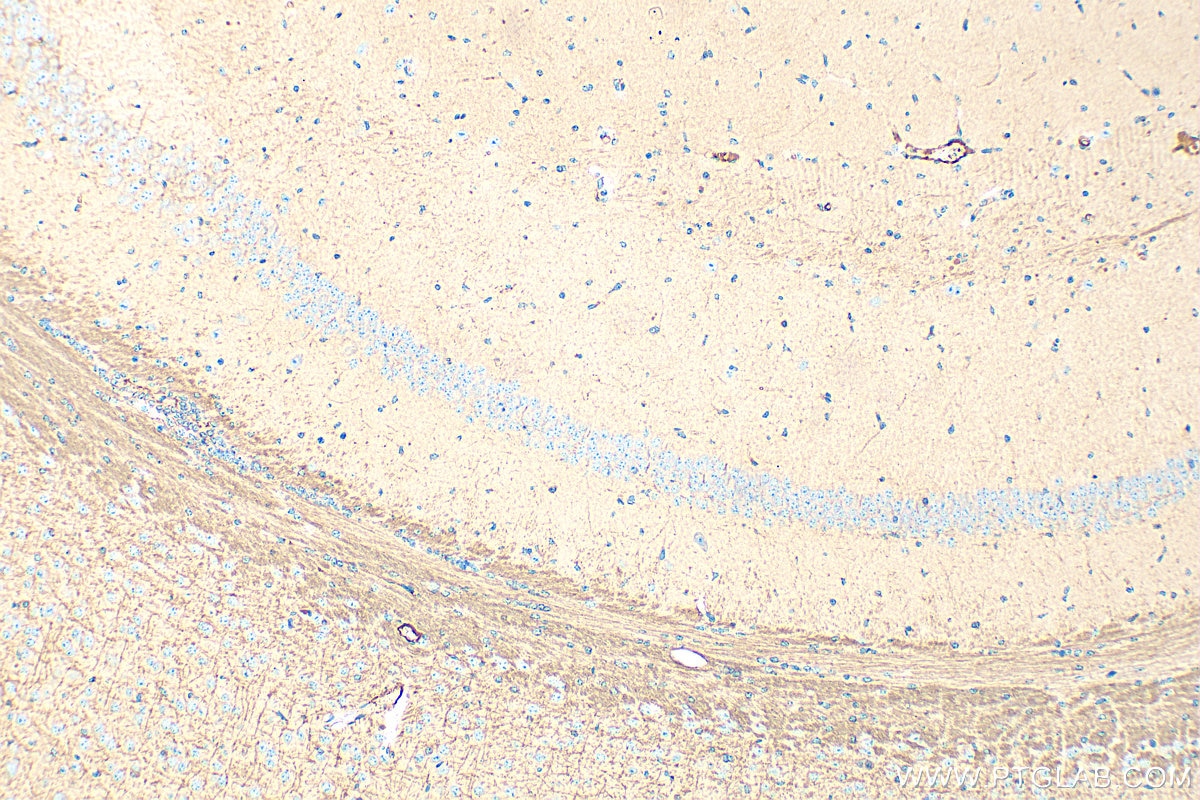 Immunohistochemistry (IHC) staining of mouse brain tissue using HEPACAM Polyclonal antibody (18177-1-AP)