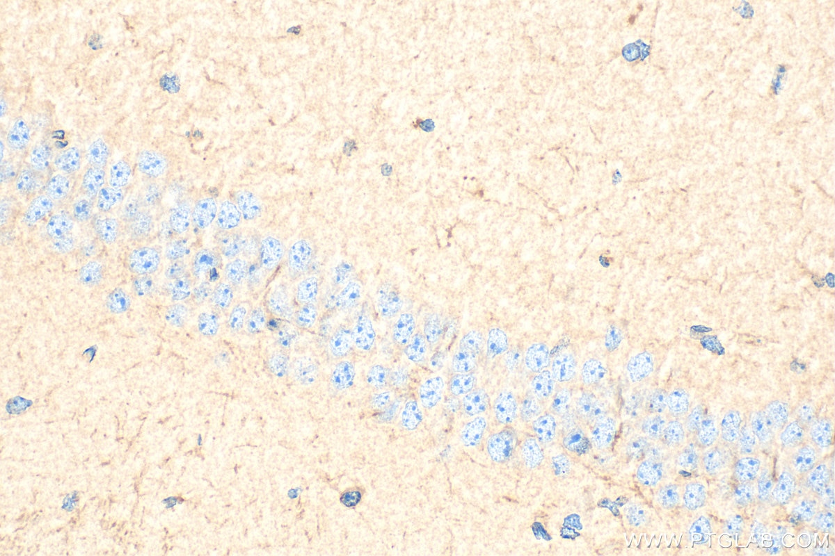 Immunohistochemistry (IHC) staining of mouse brain tissue using HEPACAM Polyclonal antibody (18177-1-AP)