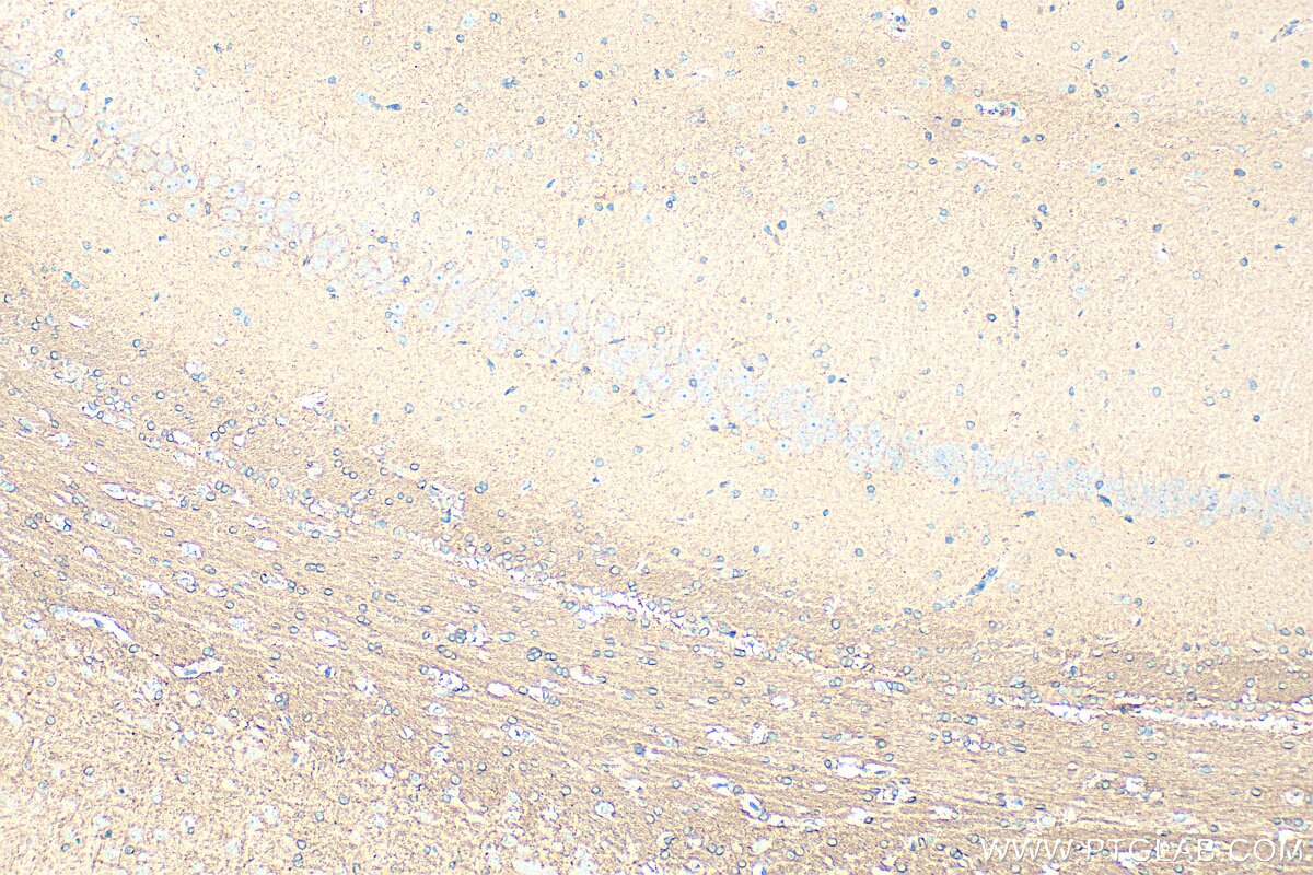 Immunohistochemistry (IHC) staining of rat brain tissue using HEPACAM Polyclonal antibody (18177-1-AP)
