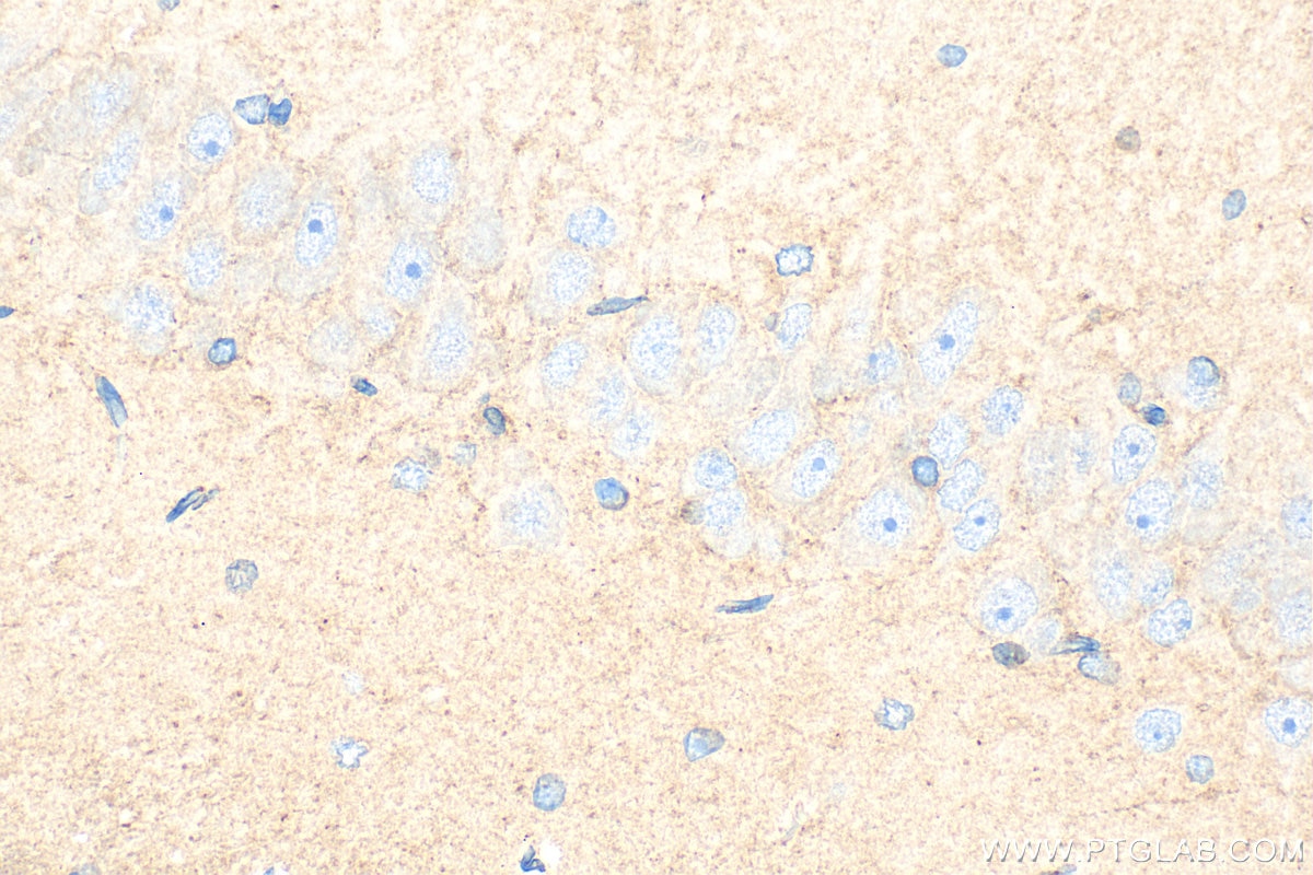 Immunohistochemistry (IHC) staining of rat brain tissue using HEPACAM Polyclonal antibody (18177-1-AP)