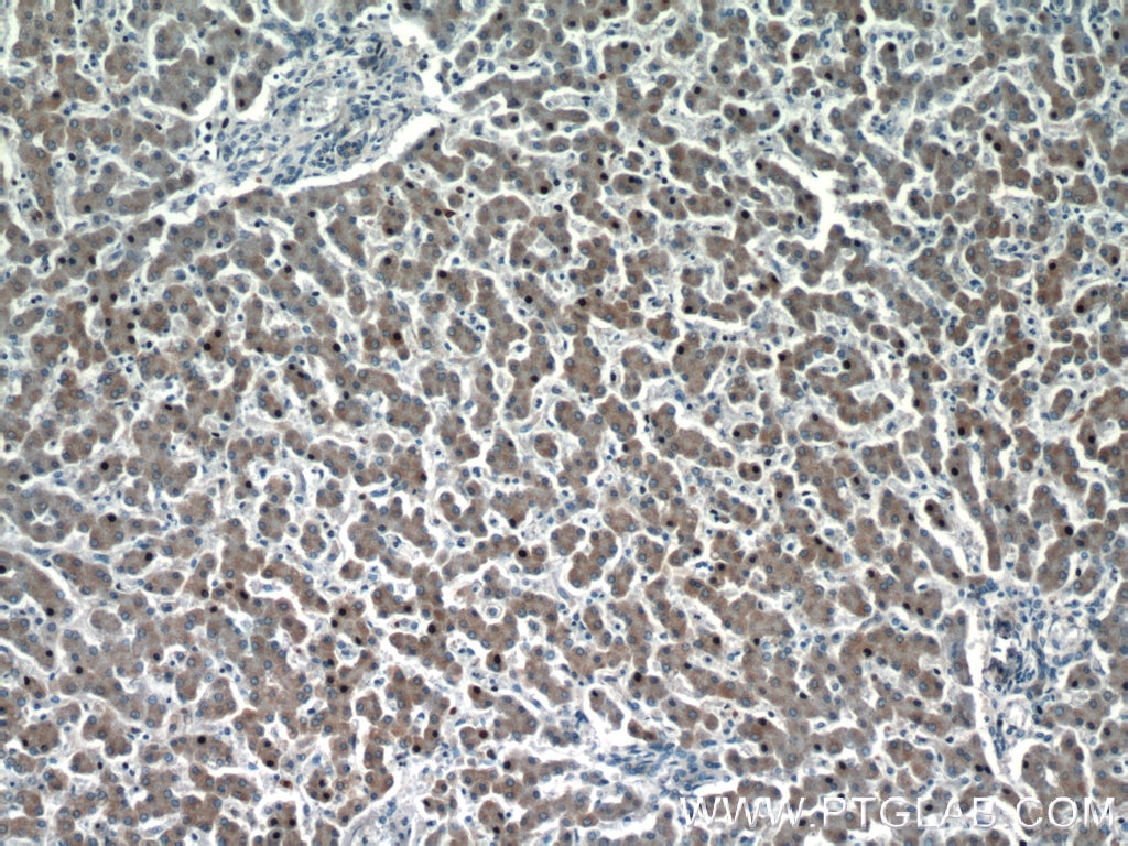 Immunohistochemistry (IHC) staining of human liver tissue using HEPACAM Polyclonal antibody (18177-1-AP)
