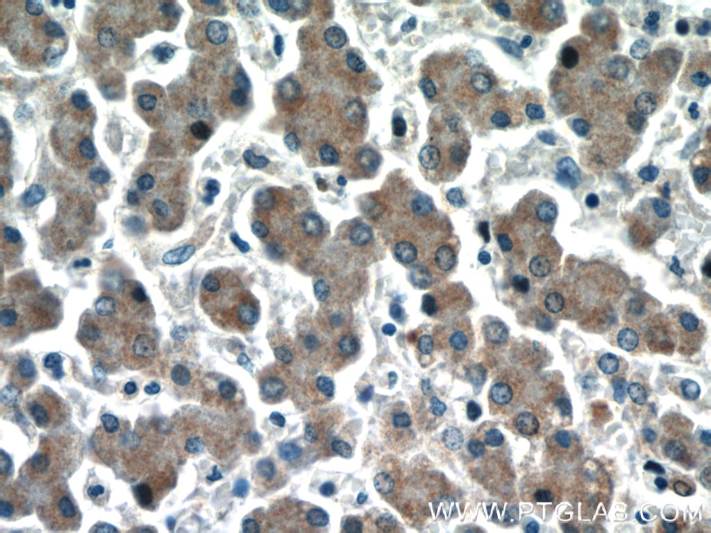 Immunohistochemistry (IHC) staining of human liver tissue using HEPACAM Polyclonal antibody (18177-1-AP)