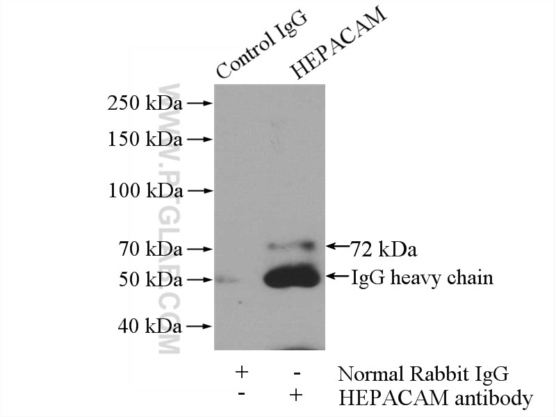 Immunoprecipitation (IP) experiment of rat brain tissue using HEPACAM Polyclonal antibody (18177-1-AP)