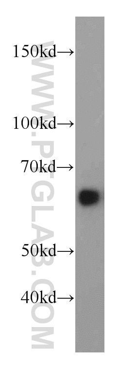 Western Blot (WB) analysis of mouse brain tissue using HEPACAM Polyclonal antibody (18177-1-AP)