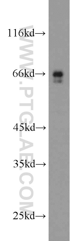 Western Blot (WB) analysis of rat brain tissue using HEPACAM Polyclonal antibody (18177-1-AP)