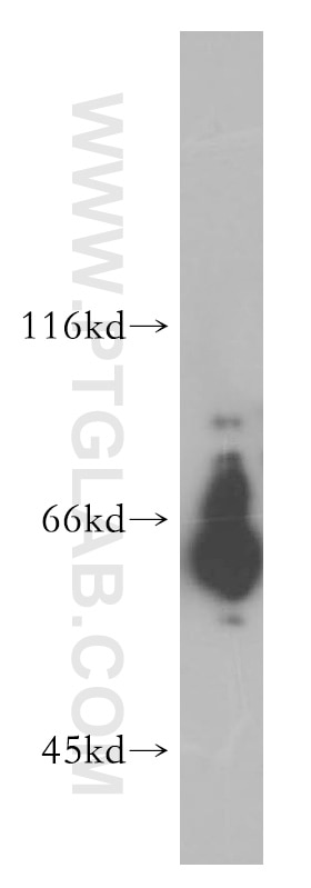 Western Blot (WB) analysis of MCF-7 cells using HEPACAM Polyclonal antibody (18177-1-AP)