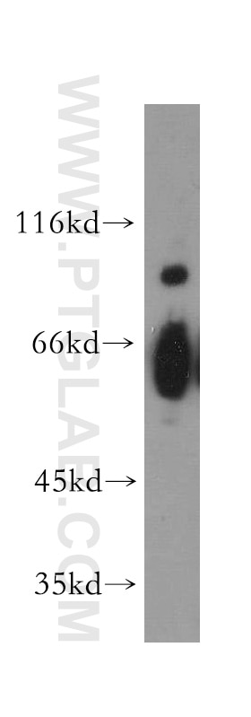Western Blot (WB) analysis of SH-SY5Y cells using HEPACAM Polyclonal antibody (18177-1-AP)