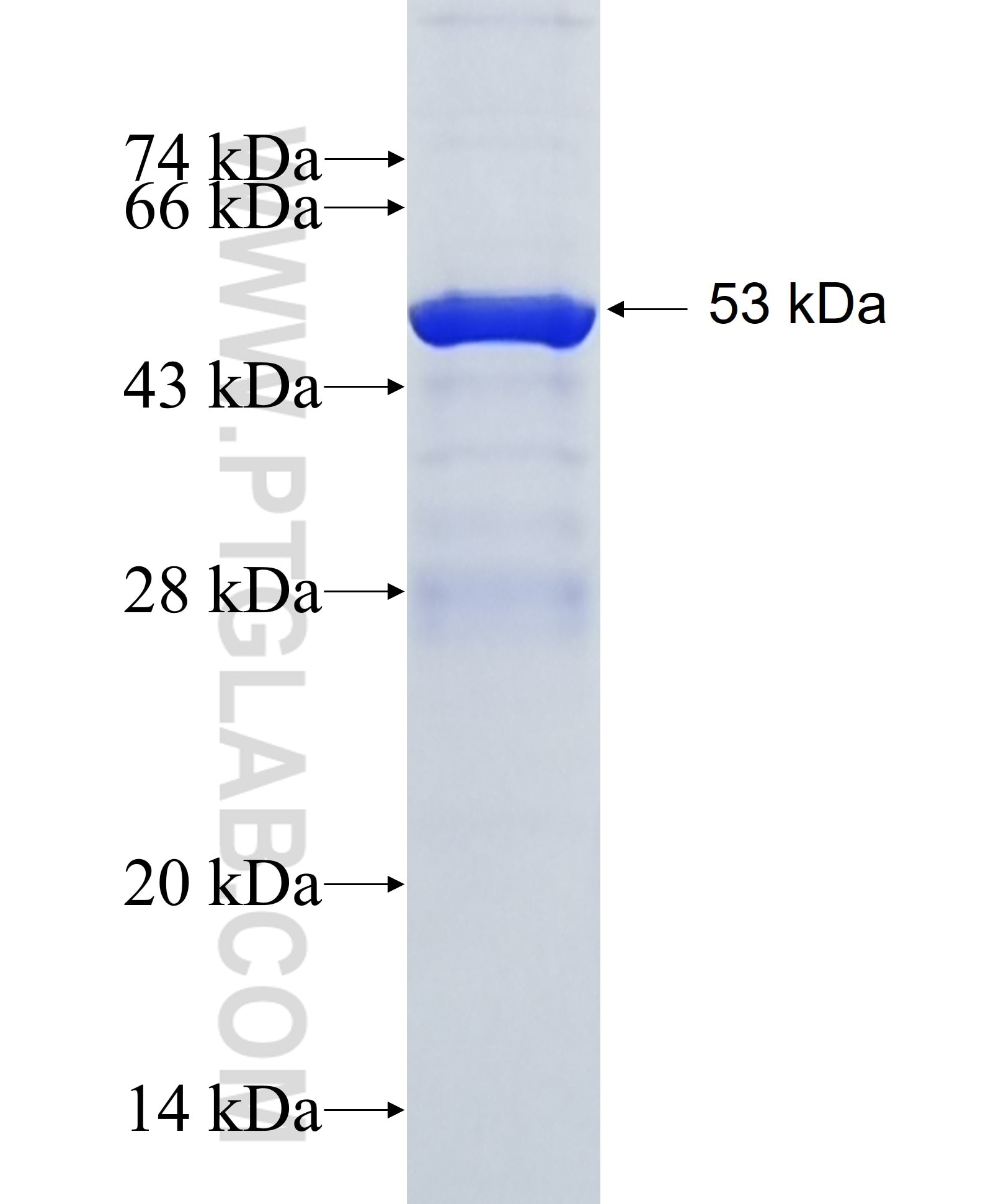 HEPACAM2 fusion protein Ag26989 SDS-PAGE