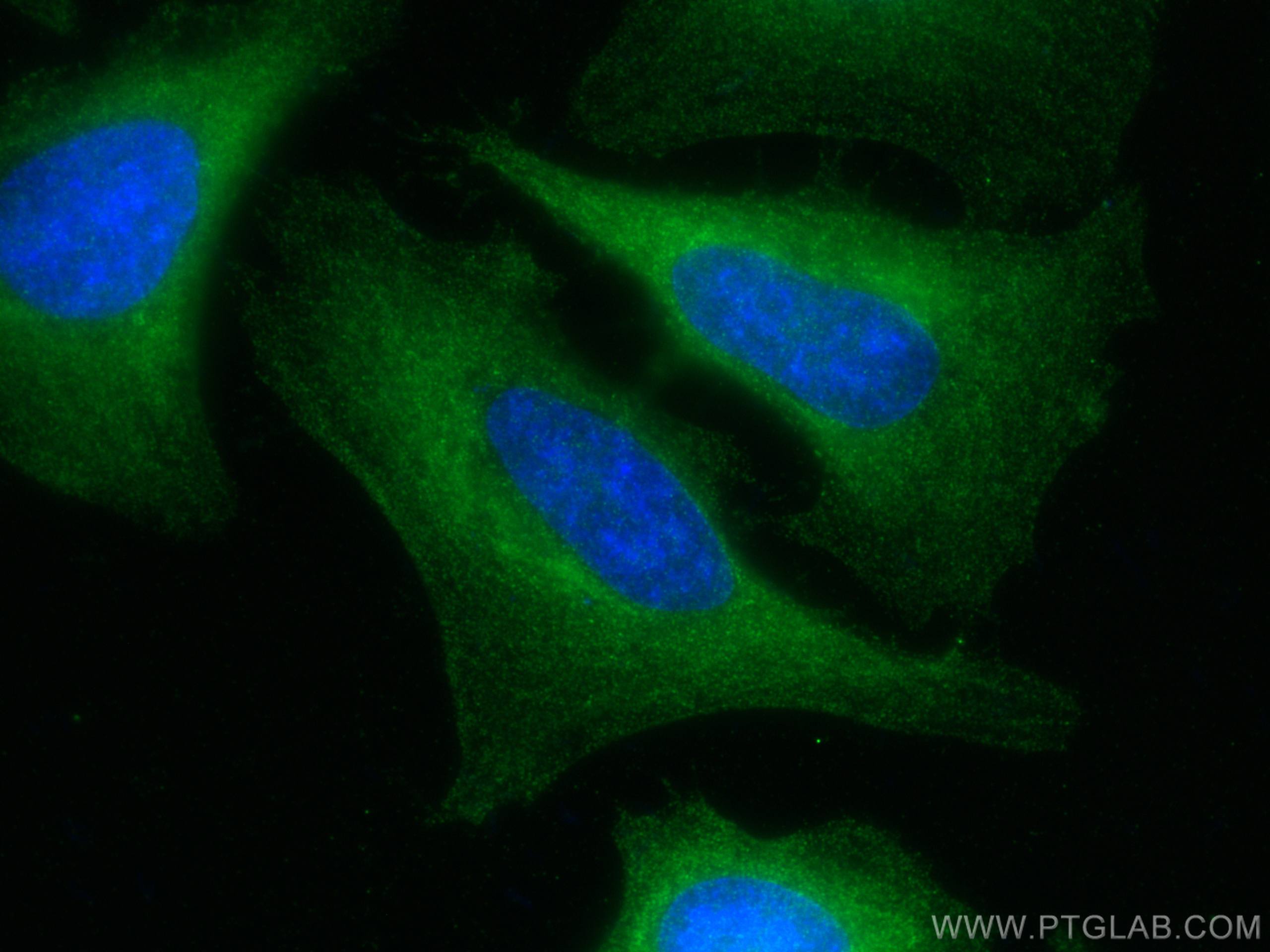 Immunofluorescence (IF) / fluorescent staining of HeLa cells using HERC4 Polyclonal antibody (13691-1-AP)