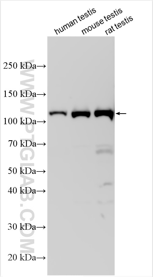 Western Blot (WB) analysis of various lysates using HERC4 Polyclonal antibody (13691-1-AP)