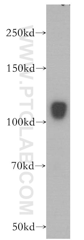 Western Blot (WB) analysis of human brain tissue using HERC4 Polyclonal antibody (13691-1-AP)