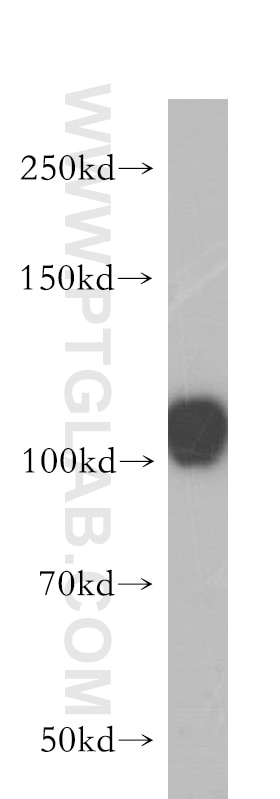 Western Blot (WB) analysis of HeLa cells using HERC4 Polyclonal antibody (13691-1-AP)