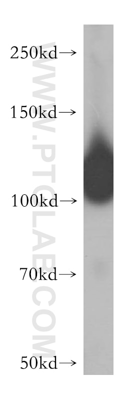 Western Blot (WB) analysis of human testis tissue using HERC4 Polyclonal antibody (13691-1-AP)