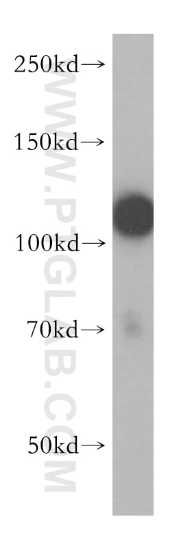 Western Blot (WB) analysis of human placenta tissue using HERC4 Polyclonal antibody (13691-1-AP)