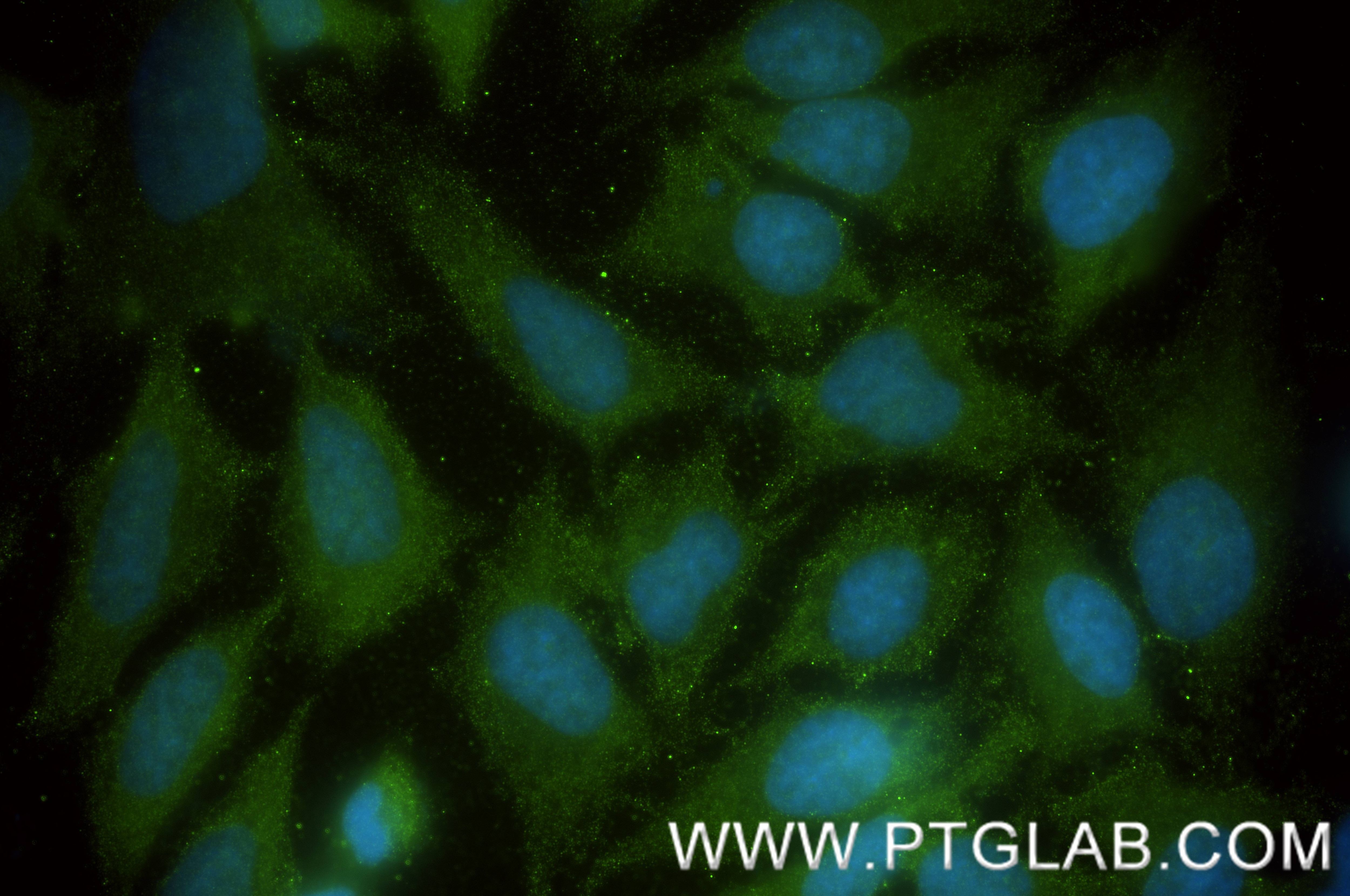 Immunofluorescence (IF) / fluorescent staining of HeLa cells using HERC4 Recombinant antibody (84952-5-RR)
