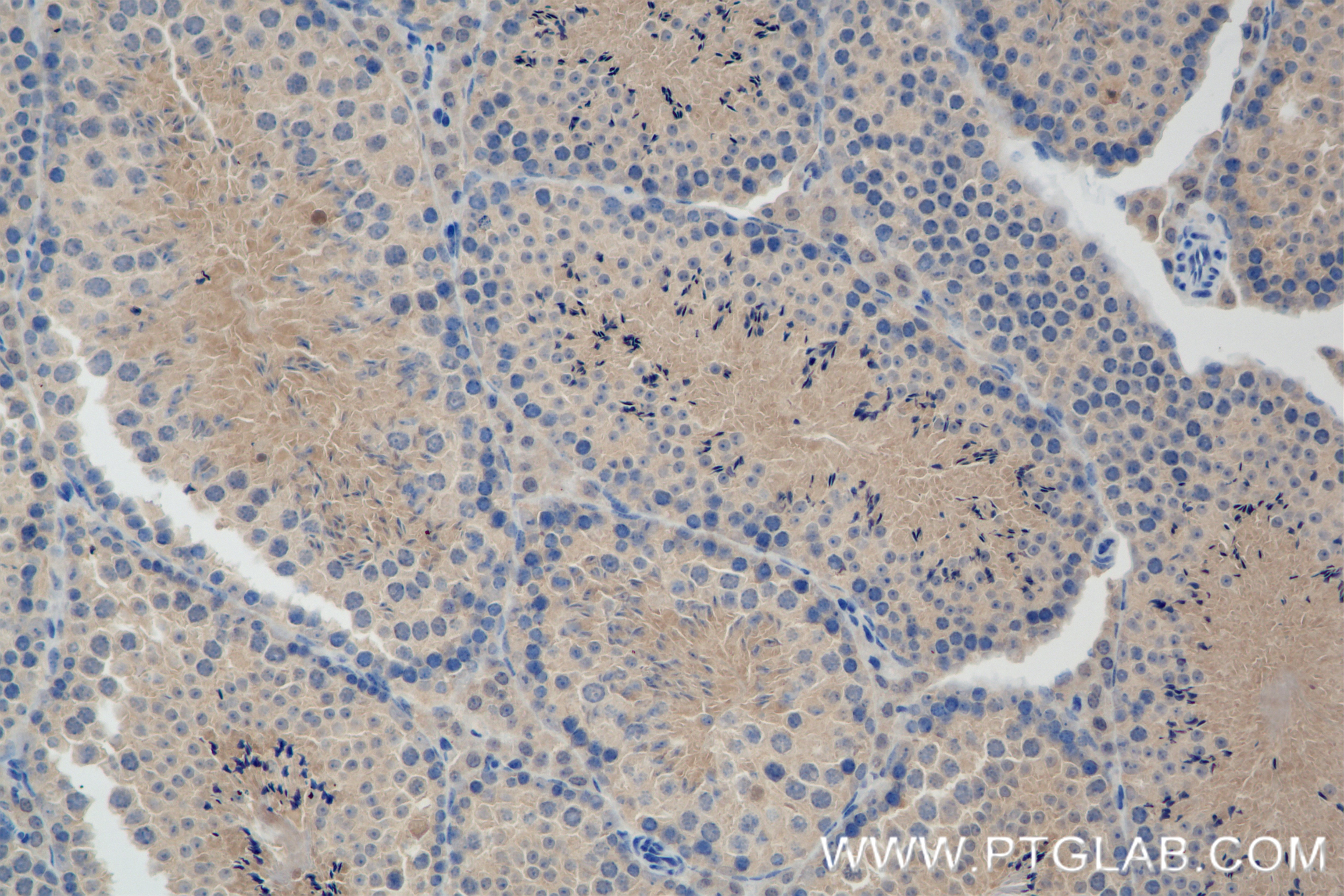 Immunohistochemistry (IHC) staining of mouse testis tissue using HERC4 Recombinant antibody (84952-5-RR)