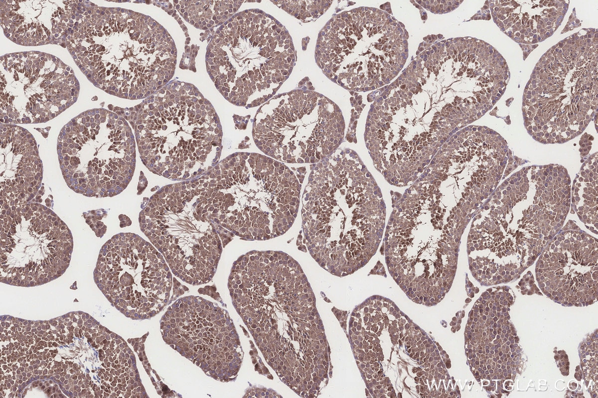IHC staining of mouse testis using 84952-5-RR Immunohistochemistry (IHC) staining of mouse testis tissue using HERC4 Recombinant monoclonal antibody (84952-5-RR)