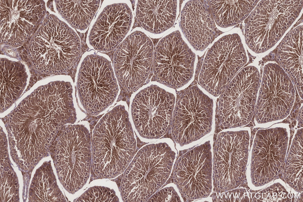 IHC staining of rat testis using 84952-5-RR Immunohistochemistry (IHC) staining of rat testis tissue using HERC4 Recombinant monoclonal antibody (84952-5-RR)
